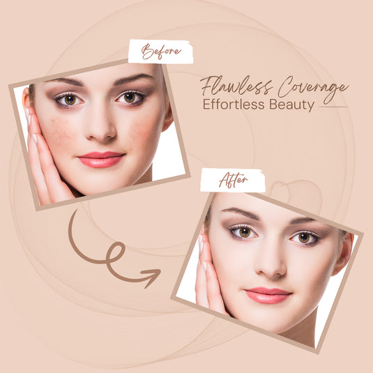 Shryoan Spot On Concealer With Niacinamide And Cica Extract